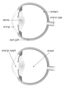 מבנה העין ופירוט חלקיה השונים